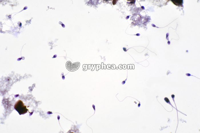 Spermatozoïdes humains pathologiques x200 - gryphea.org